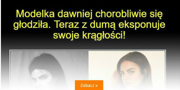 Modelka przytyła 20 kg i wygląda OBŁĘDNIE