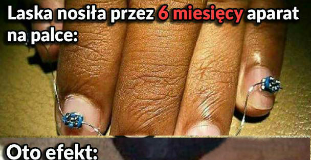Aparat na... palce. Lepiej nie róbcie tego w domu!