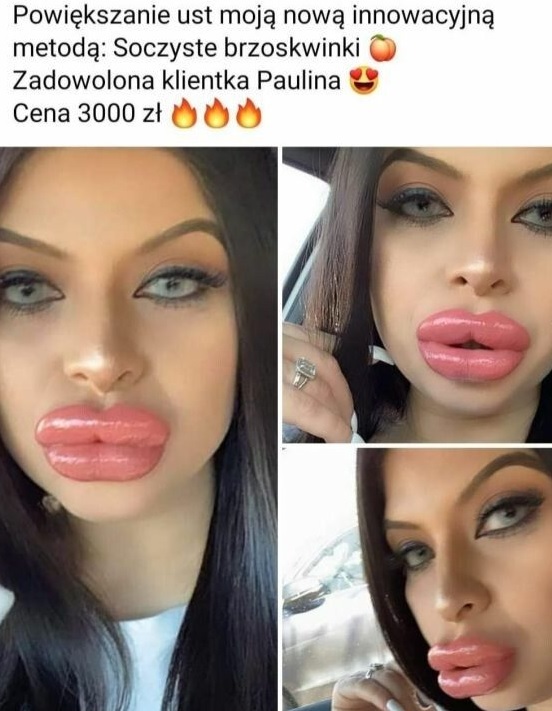 Udany zabieg? :D